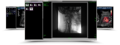 Synapse VNA